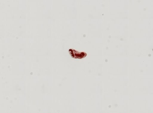 Trematoda
