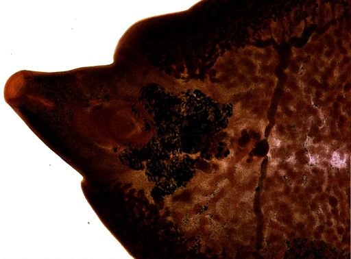 Fasciola hepatica
