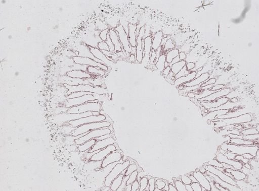 Leucosolenia sp.