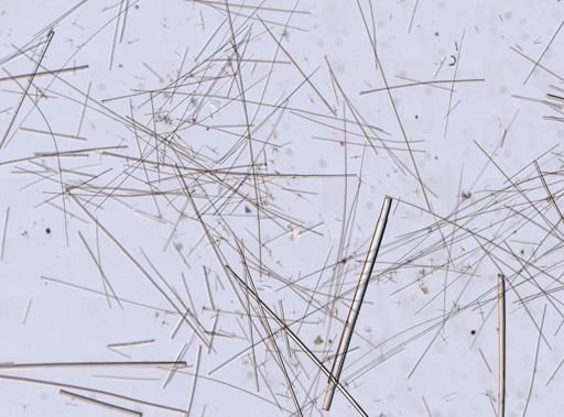 Hexactinellida