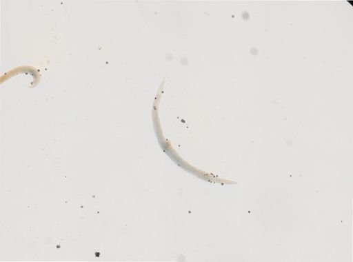 Strongyloides stercoralis