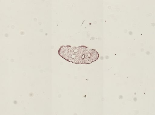 Dicrocoelium dendriticum