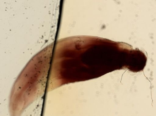 Oligacanthorhynchus microcephalus