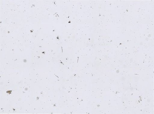 Stromatospongia micronesica