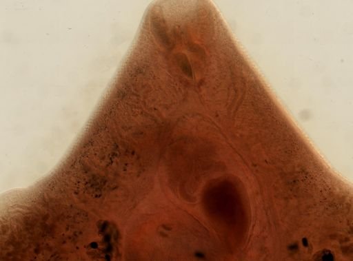 Fasciola hepatica