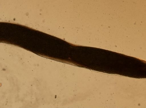 Enterobius vermicularis