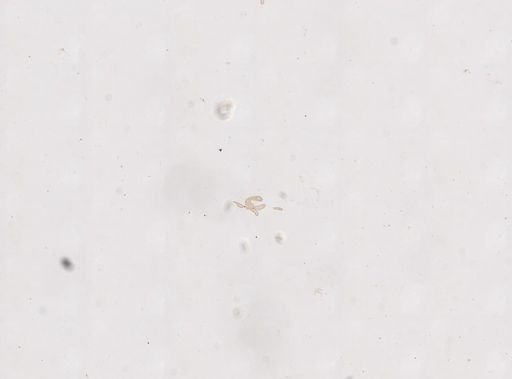 Halammohydra schulzei