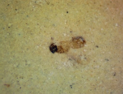 undet. Endopterygota