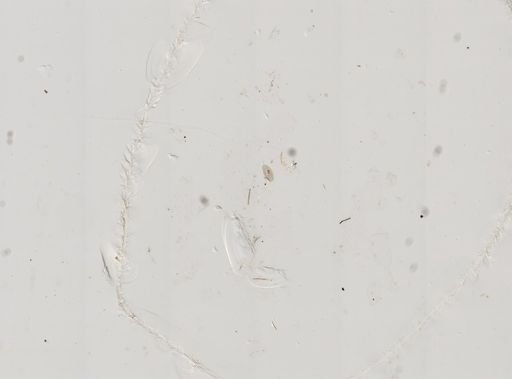 Paramecium