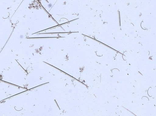 Cladorhiza abyssicola