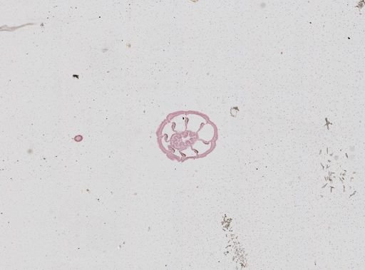 Nematostella