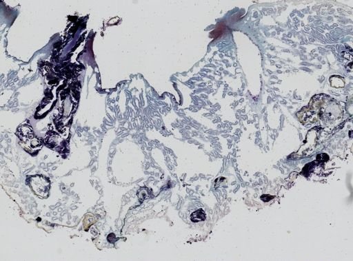 Aplysilla