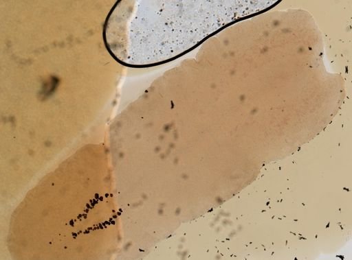 Prosthiostomum lobatum