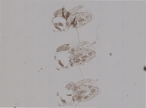Macrosiphum rosae