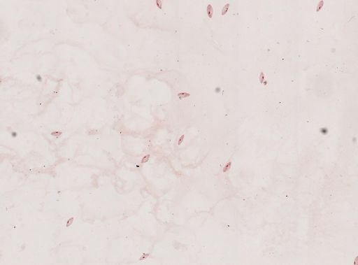 Paramecium