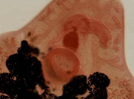 Fasciola hepatica