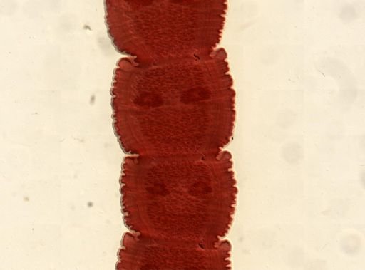 Dipylidium caninum