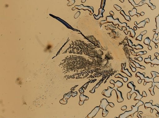 Sphaeroma quadridentatum
