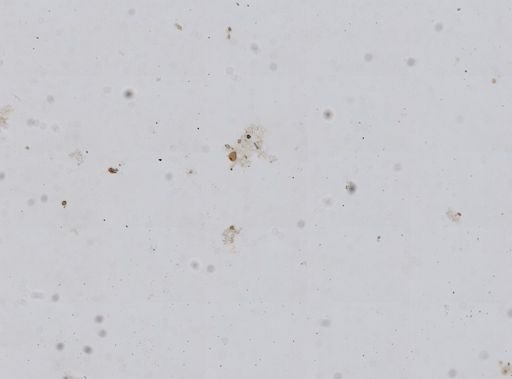 Dysidea etheria