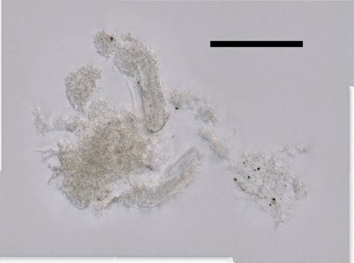 Chelophyes appendiculata