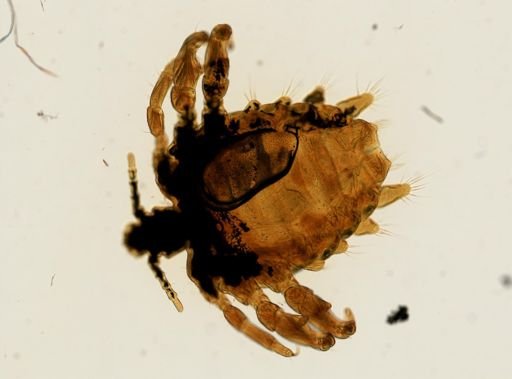 Pthirus pubis