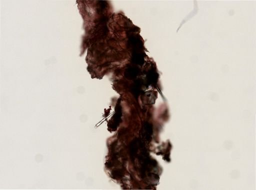 Haliclona