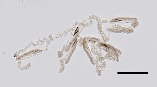 Rosacea cymbiformis