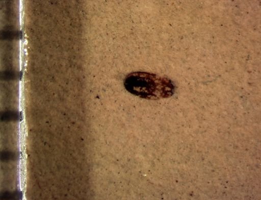 undet. Coleoptera