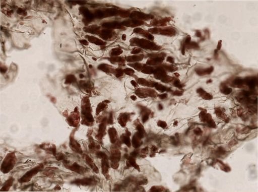 Alcyonidium