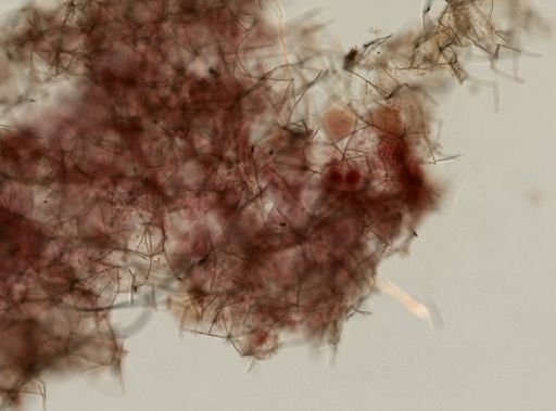 Haliclonidae