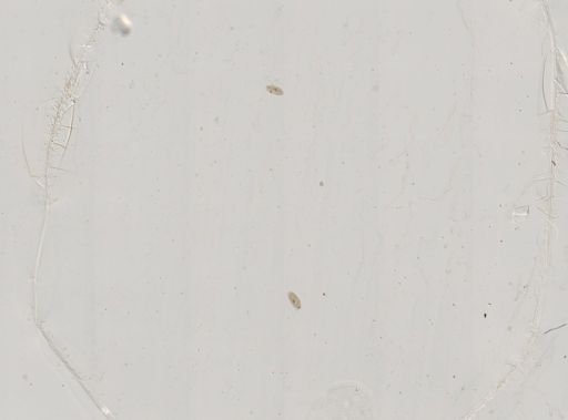 Paramecium
