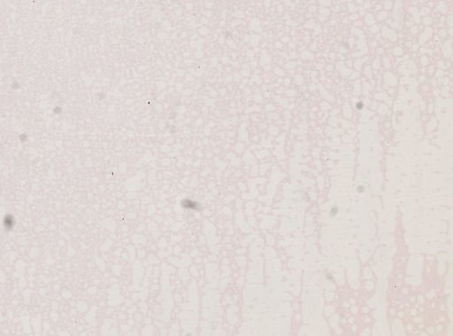 Plasmodium vivax