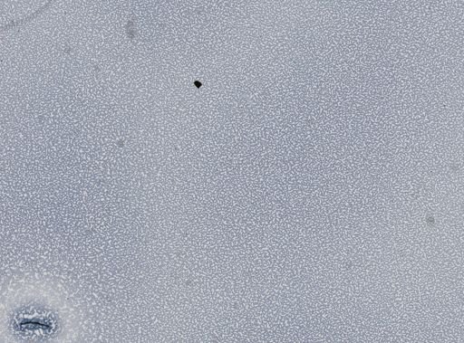 Plasmodium vivax