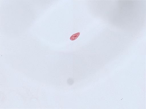 Paramecium aurelia