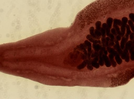 Clonorchis sinensis