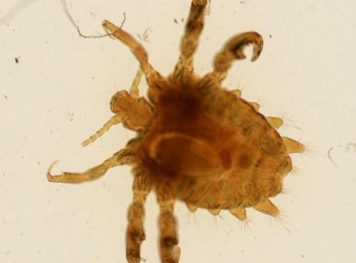 Pthirus pubis