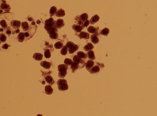 Echinococcus granulosus