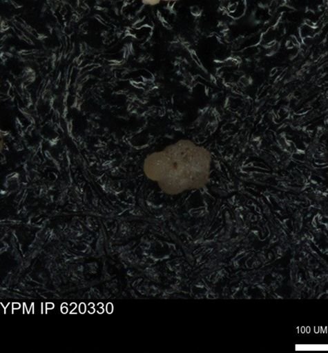undet. Rugoglobigerinidae