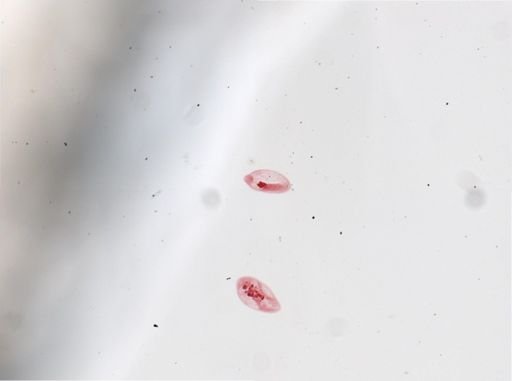 Paramecium calkinsi