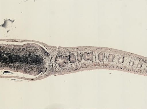 Turbellaria