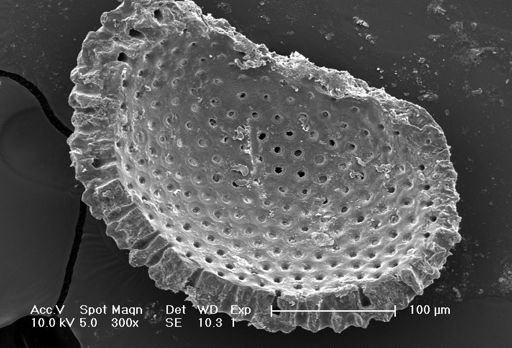 Globigerinoides sacculifer