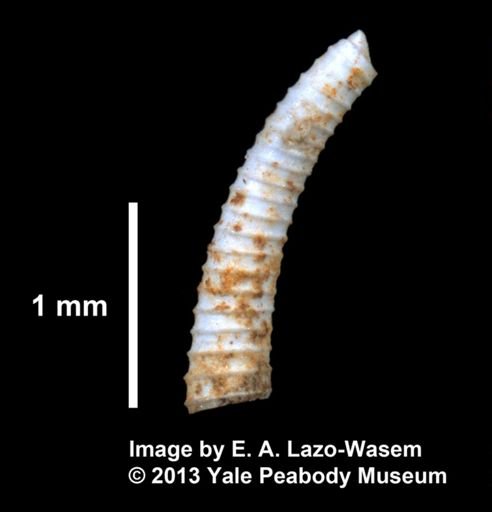 Caecum