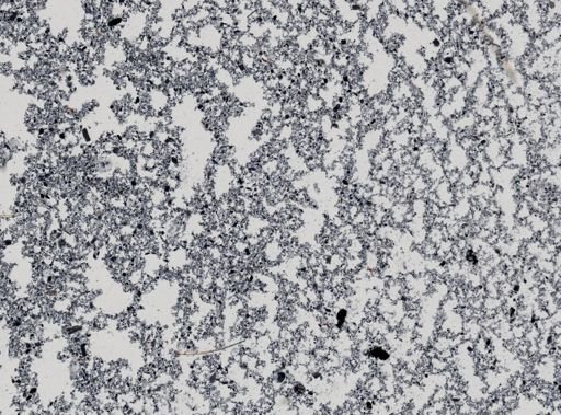 Giardia lamblia