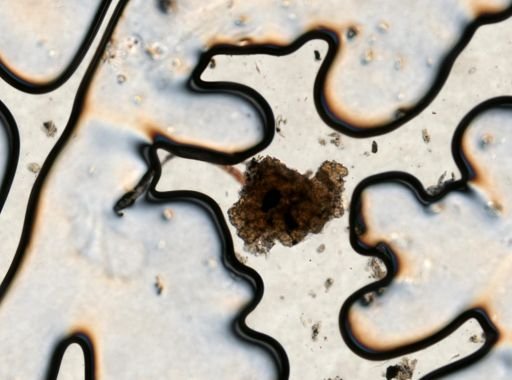 Fasciolopsis buski