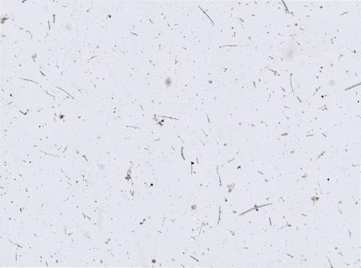 Stromatospongia micronesica