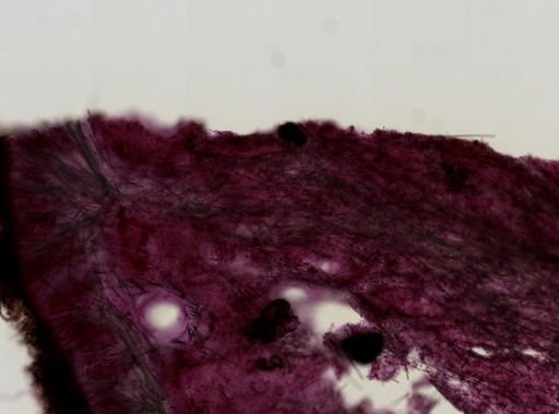 Myrmekioderma