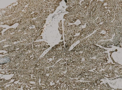 Plakortis sp.