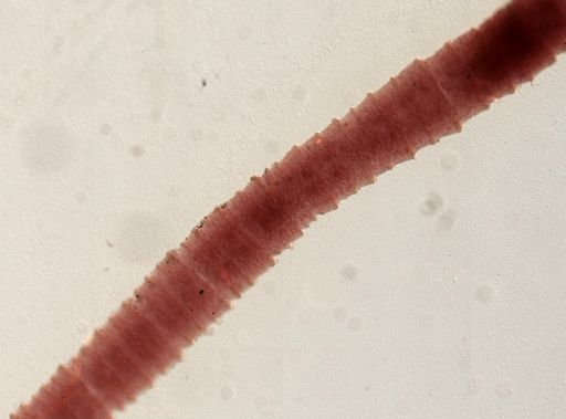 Eucestoda