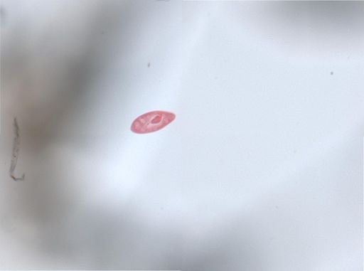 Paramecium aurelia