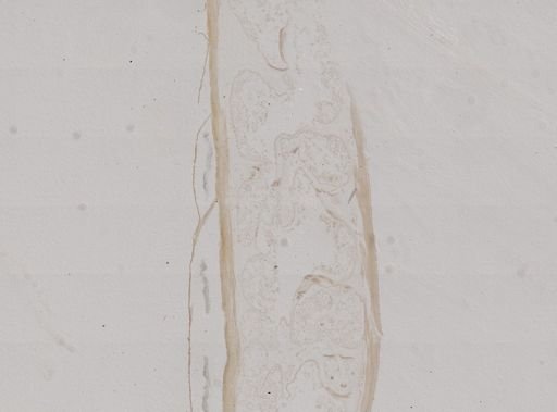 Nectonemertes mirabilis